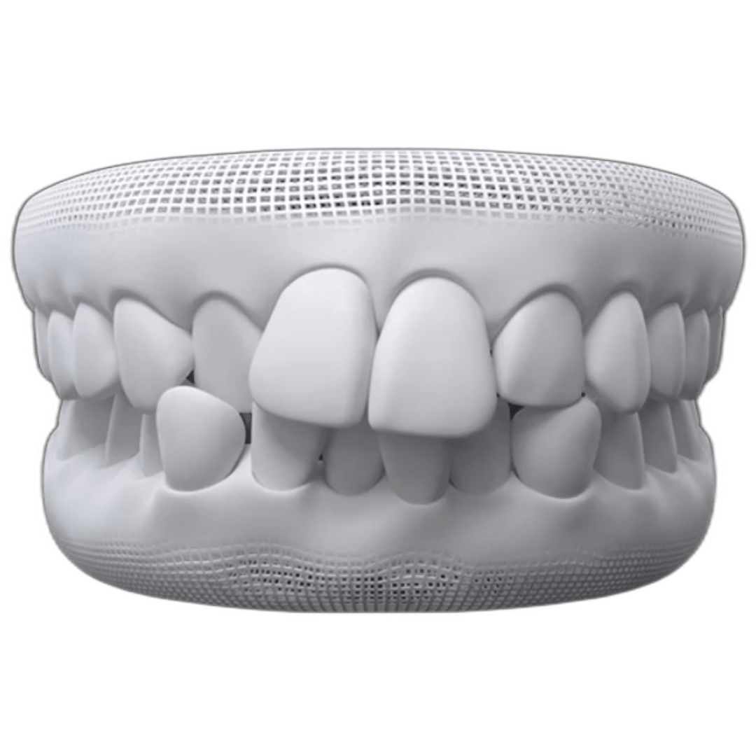 CrowdedTeeth.png