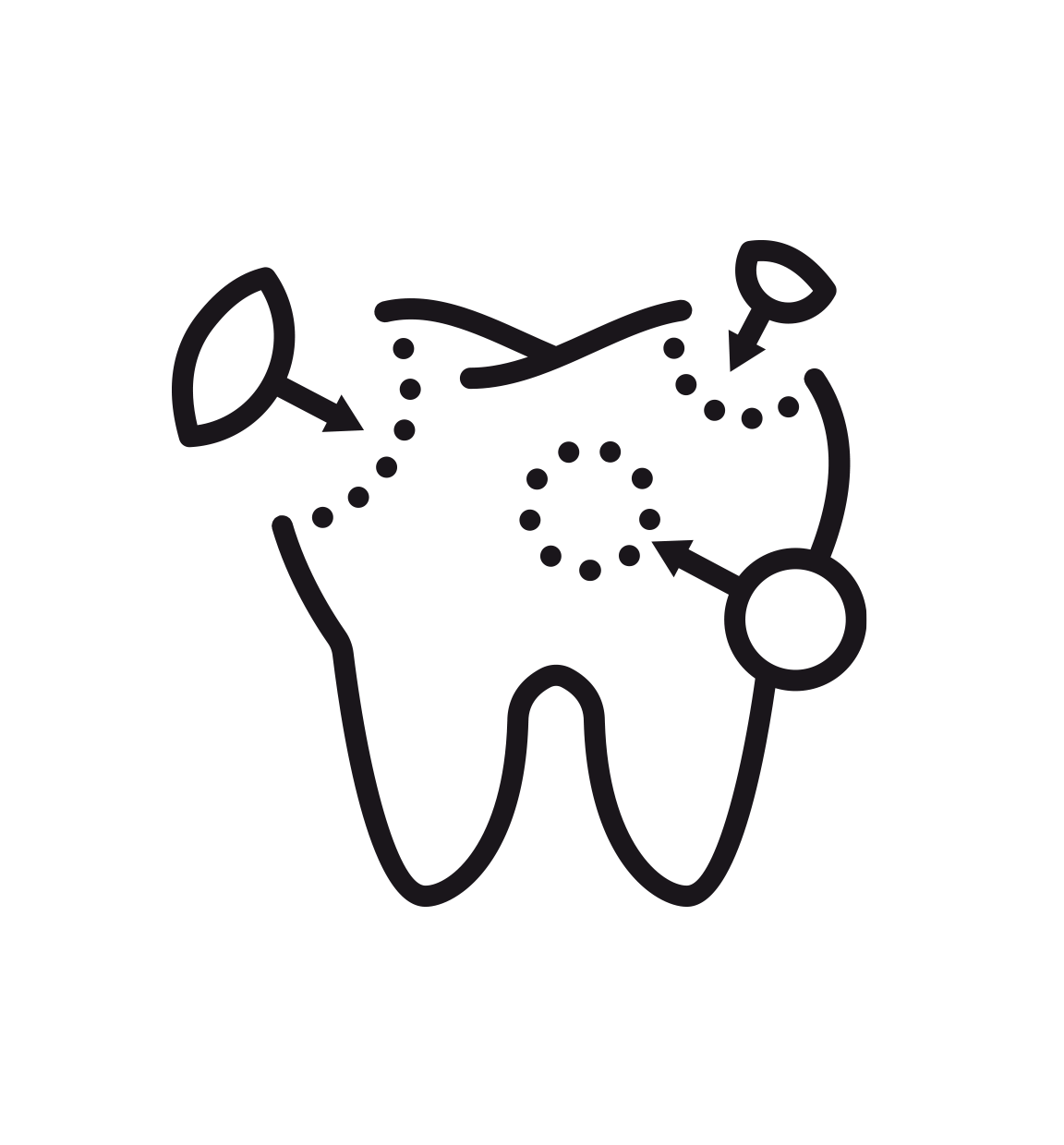 Root-Canal.png