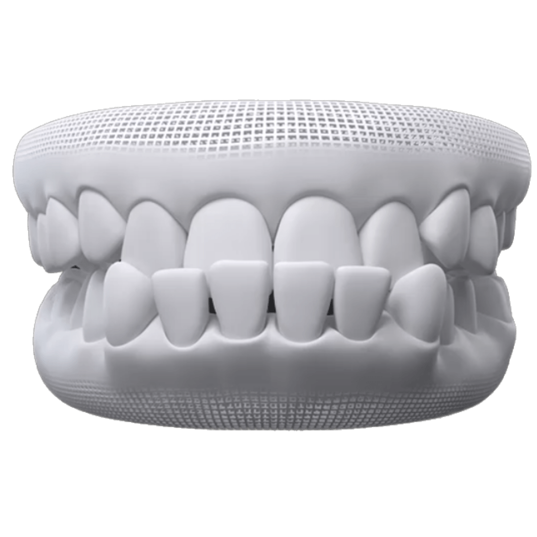 UnderBite.png