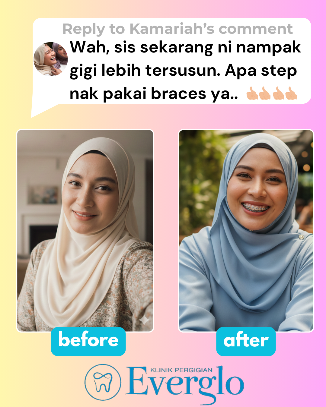 Before after (1)