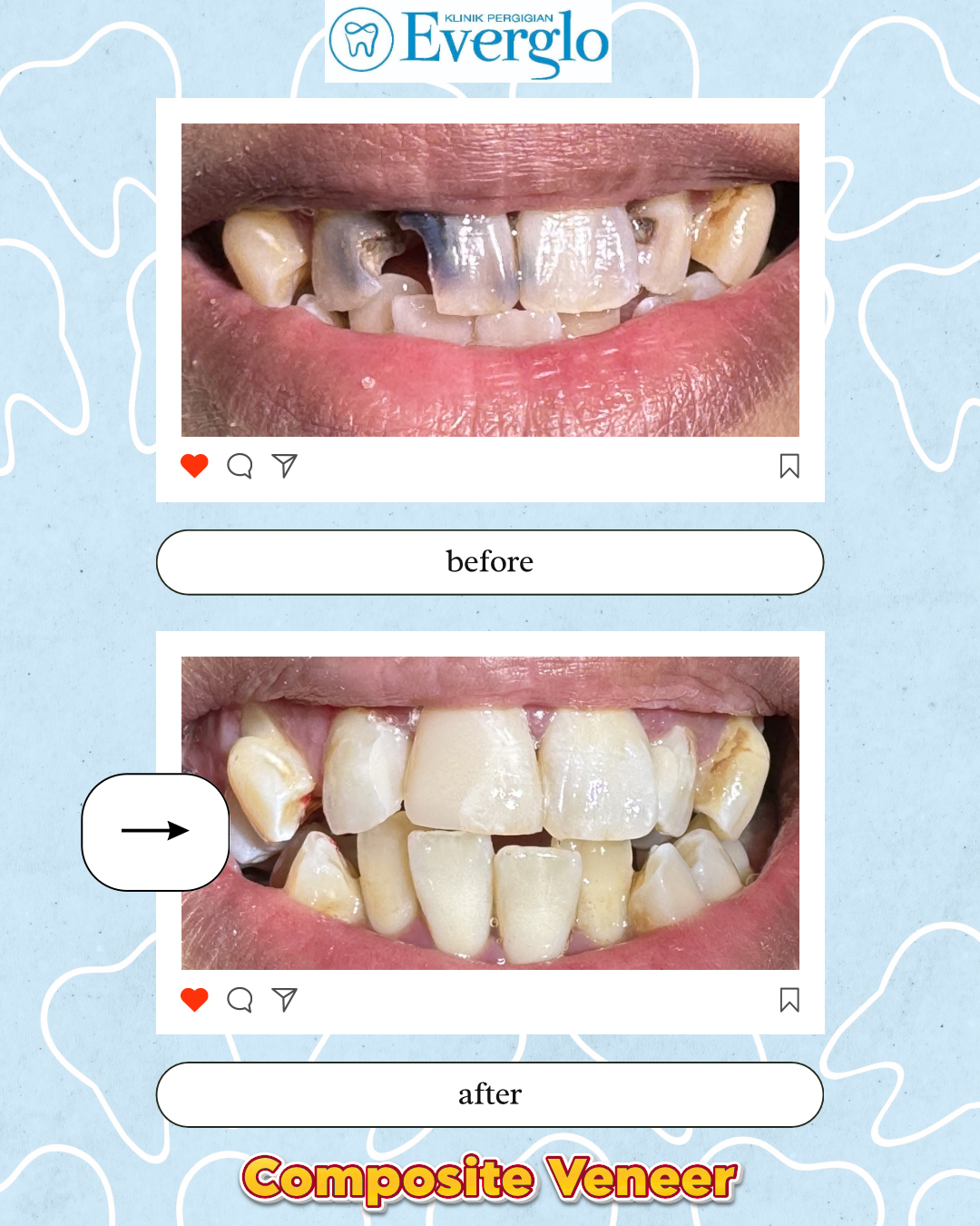 Beige Minimalist Beauty Skincare Before After Instagram Post – 10