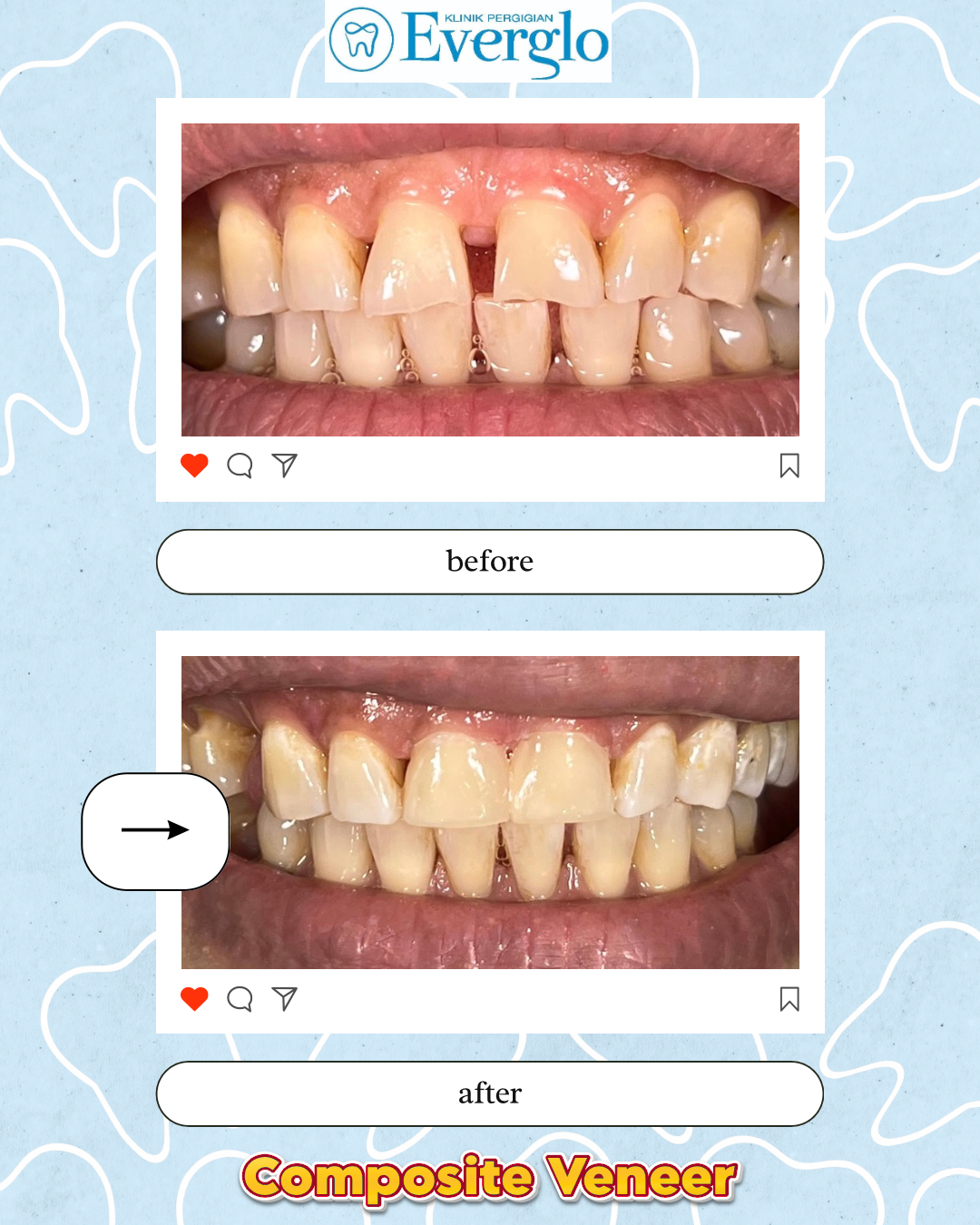 Beige Minimalist Beauty Skincare Before After Instagram Post – 11