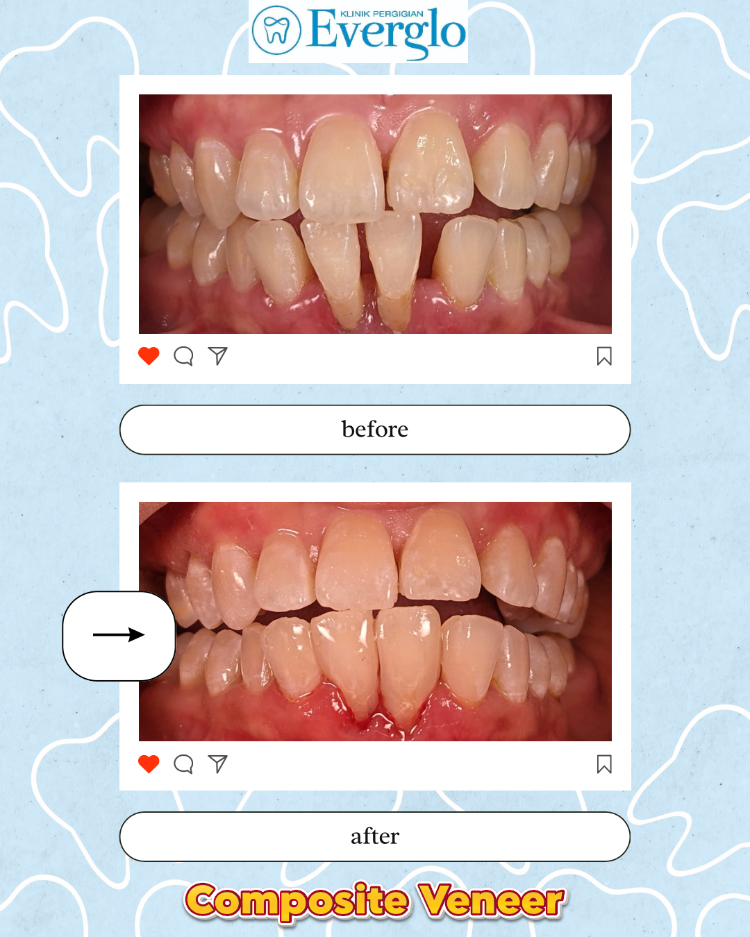 Beige Minimalist Beauty Skincare Before After Instagram Post – 13
