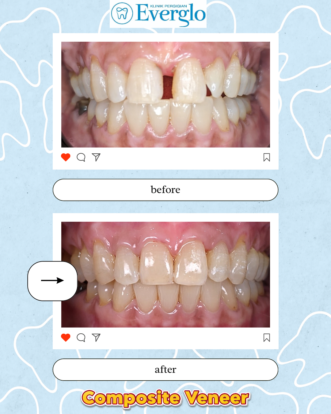 Beige Minimalist Beauty Skincare Before After Instagram Post – 14