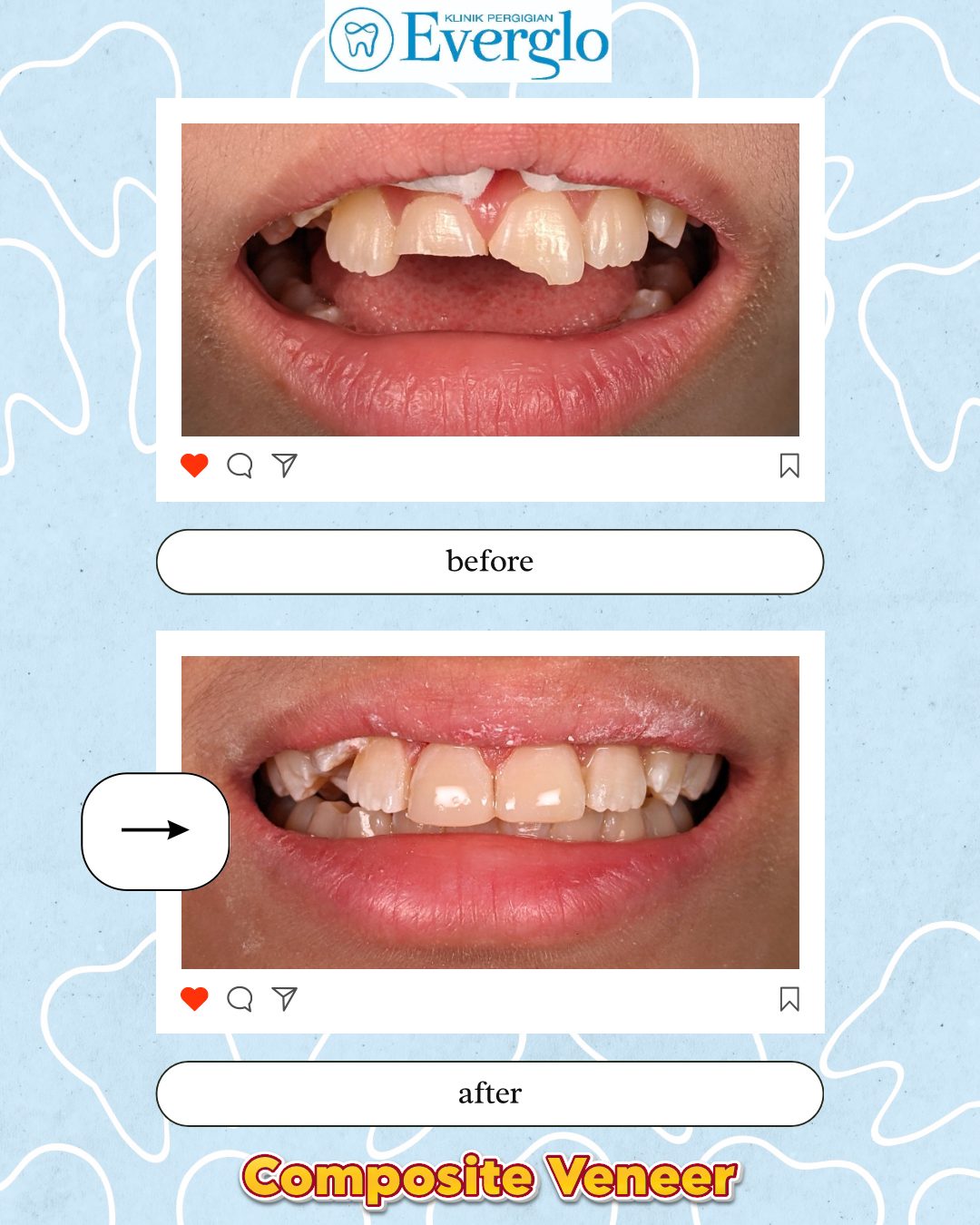 Beige Minimalist Beauty Skincare Before After Instagram Post – 15