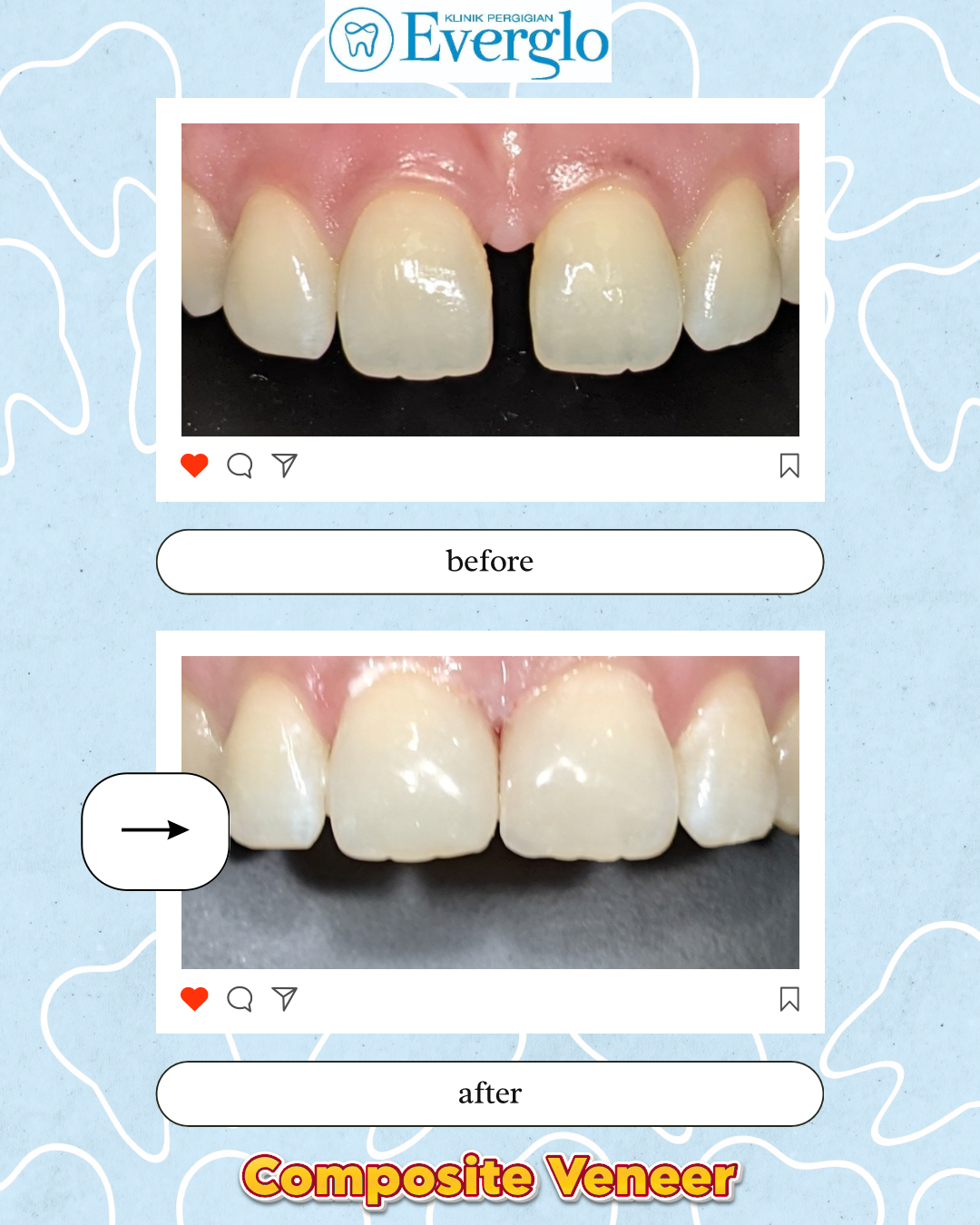 Beige Minimalist Beauty Skincare Before After Instagram Post – 16