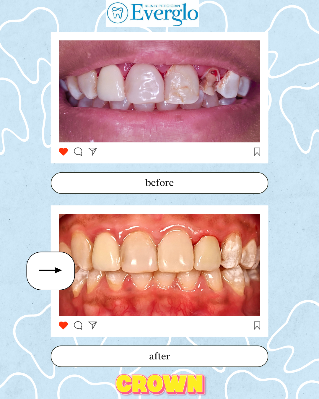 Beige Minimalist Beauty Skincare Before After Instagram Post – 2(1)
