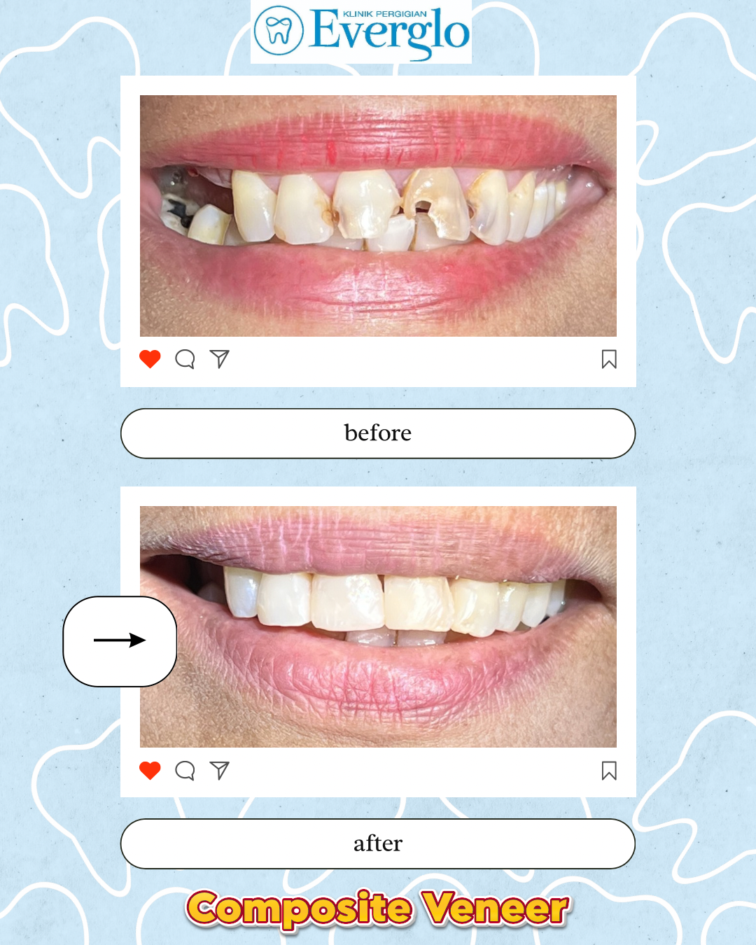 Beige Minimalist Beauty Skincare Before After Instagram Post – 9