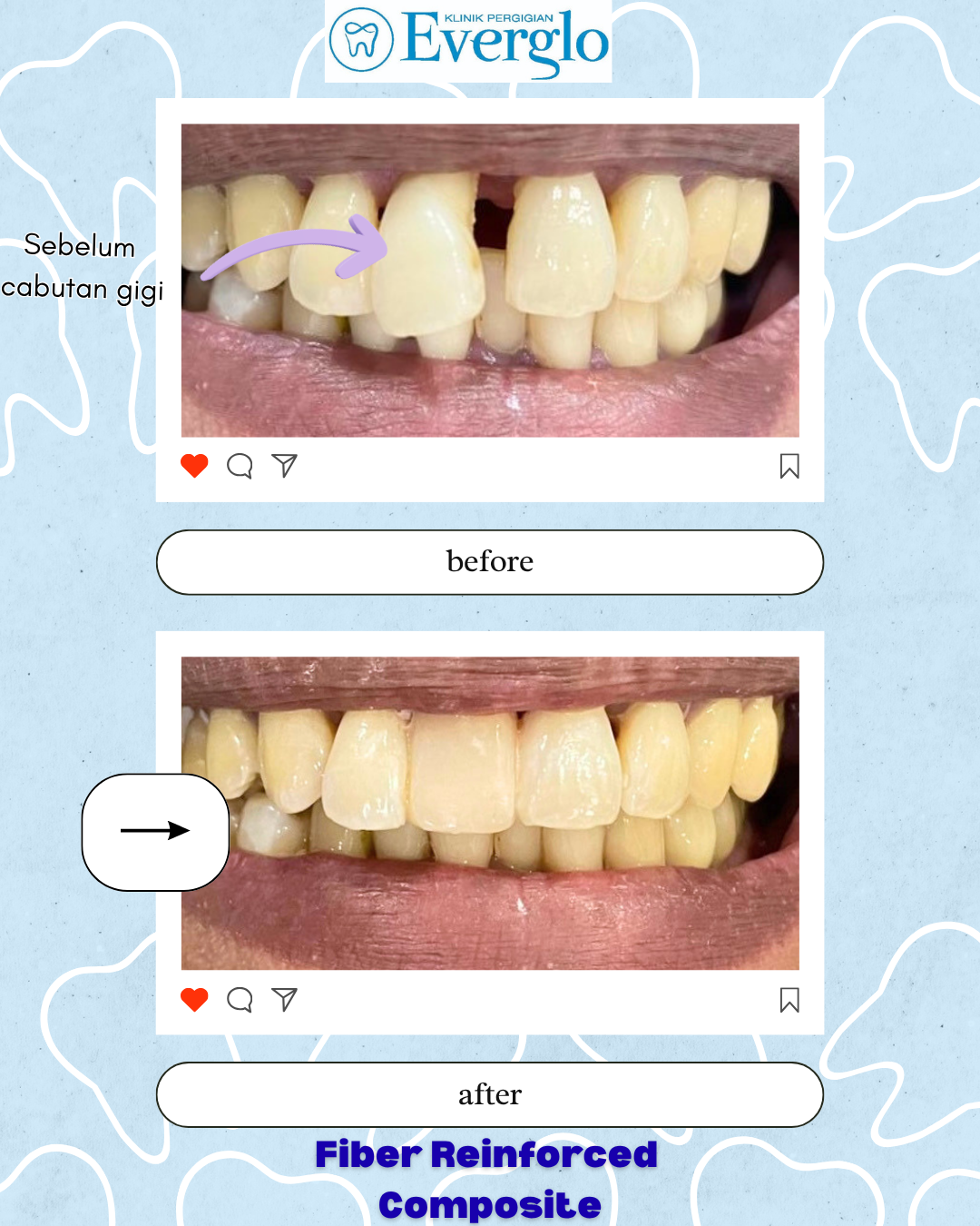 Beige Minimalist Beauty Skincare Before After Instagram Post(2)