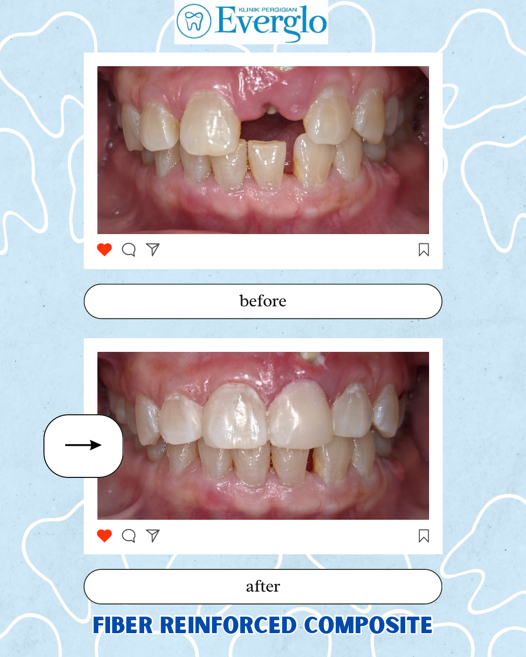 Beige Minimalist Beauty Skincare Before After Instagram Post(4)