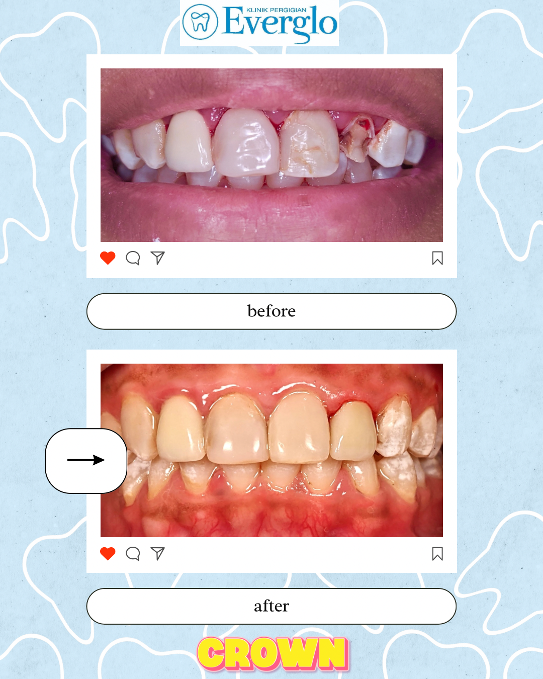 Beige Minimalist Beauty Skincare Before After Instagram Post(5)
