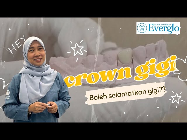Crown Gigi - Boleh selamatkan gigi