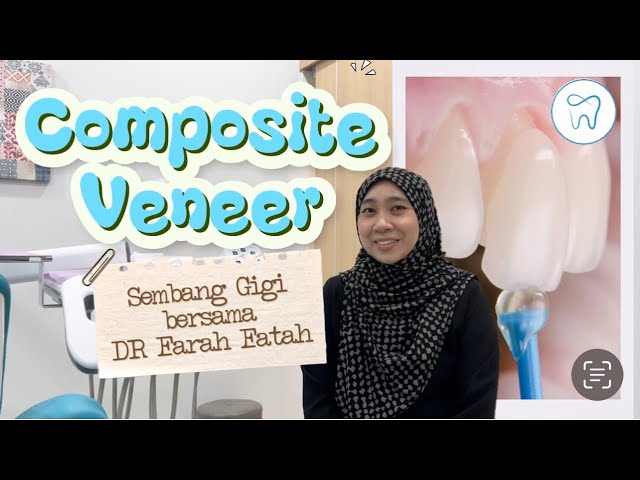 Composite Veneer